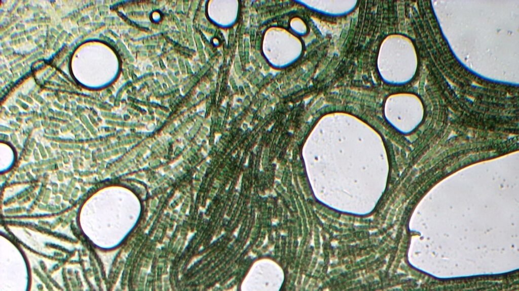 Spiruline au microscope, Arthrospira platensis